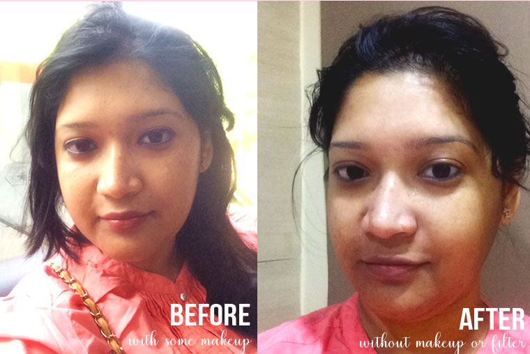 before-and-after-photos-facial-vlcc-bellewave-hydrowave