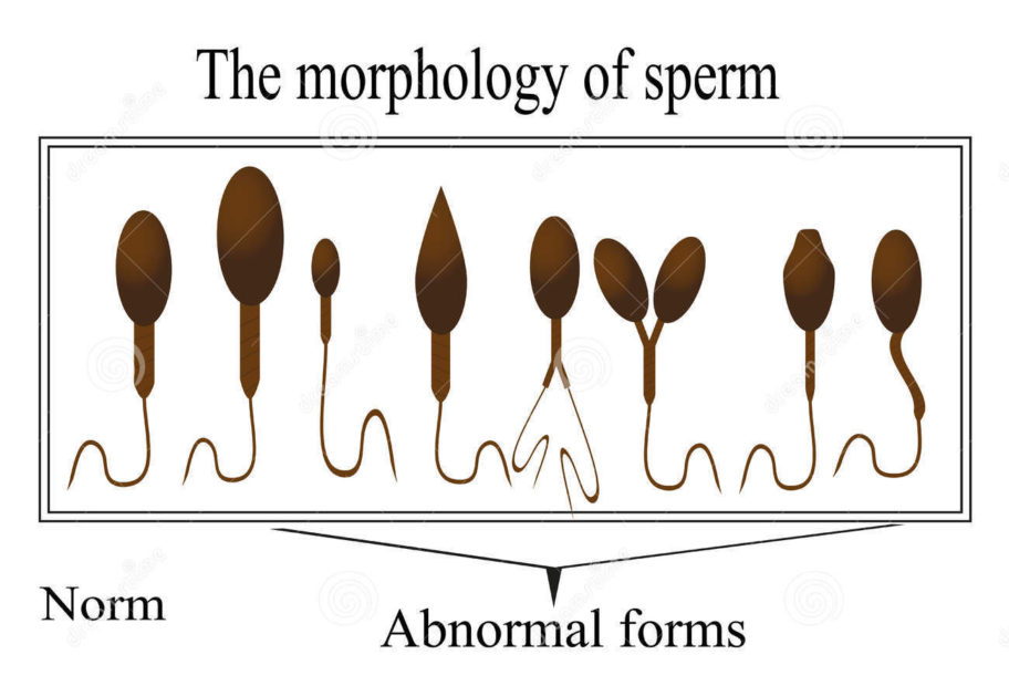 sperm morphology