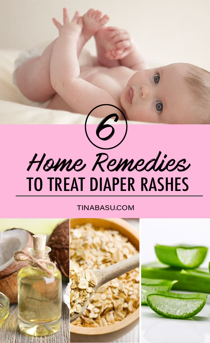 6-effective-home-remedies-to-treat-diaper-rash-in-babies-babycare