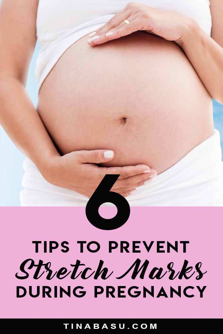 tips to prevent stretch marks during pregnancy