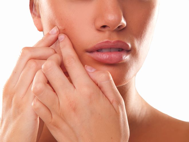 what causes acne - picking pimple