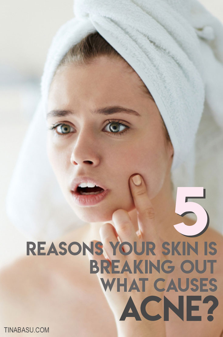 What causes acne - reasons why you are breaking out