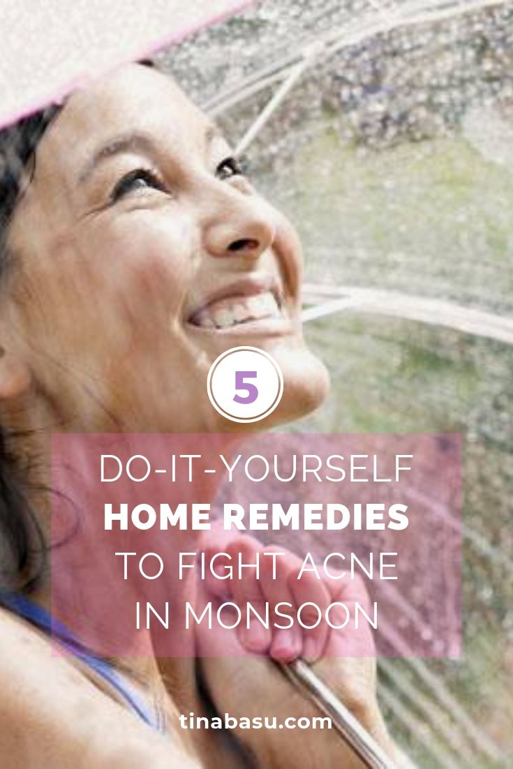 home remedies to fight acne in monsoon pinterest