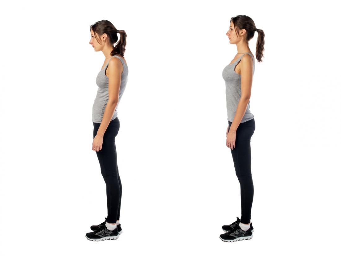 resolve-diastasis-recti-without-surgery-good-posture