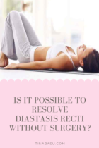 Exploring the Alternatives: Is It Possible to Resolve Diastasis Recti ...