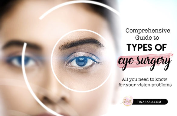 guide-to-types-of-eye-surgery-lasik-smile